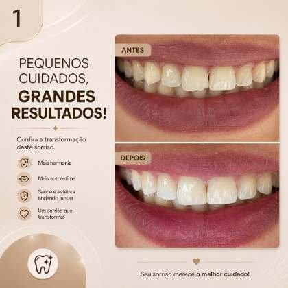 Caso clínico acompanhado no Instituto IOIS
