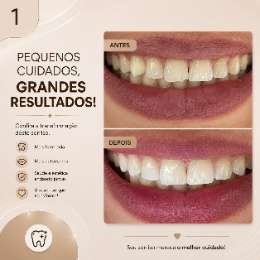 Caso clínico acompanhado no Instituto IOIS